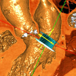 Mitral 4 x 4 Rev1