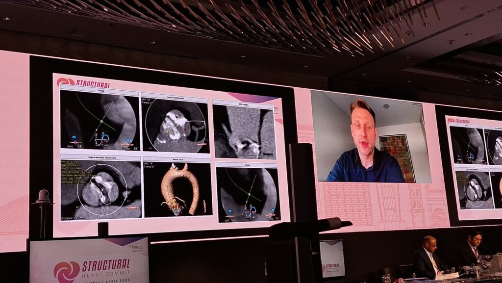 P&F presentation at the Structural Heart Summit Mumbai 2025