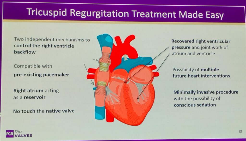 Tricuspid Regurgitation Treatment Made Easy presentation slide