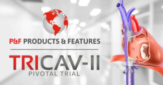 P&F secures FDA approval for The TricValve® Transcatheter bicaval valve system