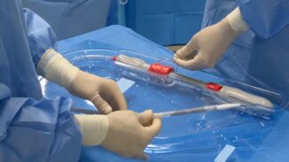 photo of physician hands using P&F TricValve® Transcatheter Bicaval Valves System